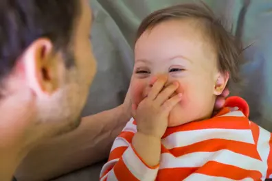 Strengthening support for those with Down Syndrome