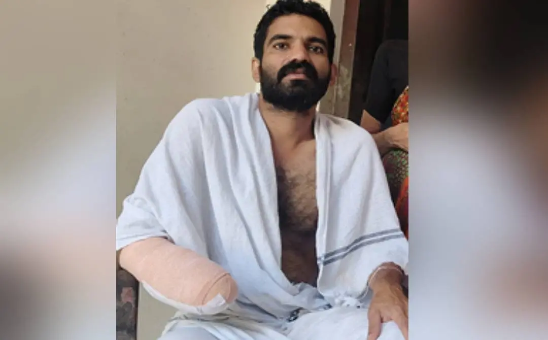 Rajesh's palm amputated