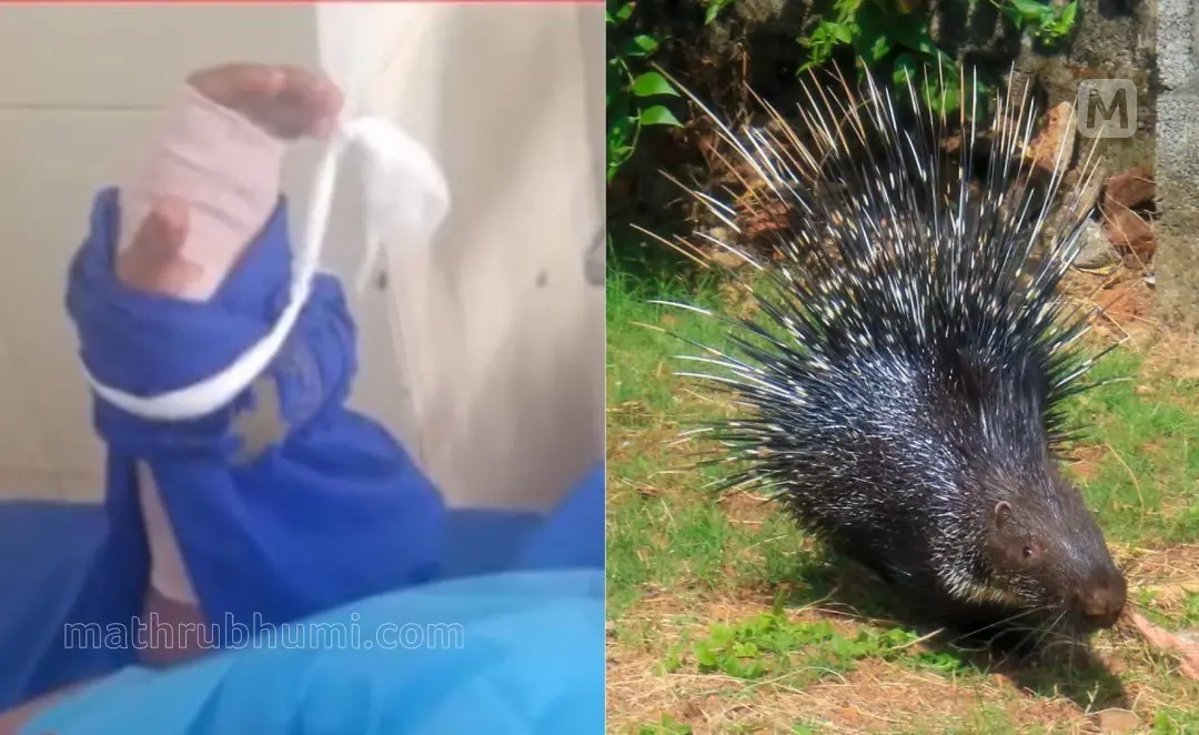 Plus One student injured in porcupine attack