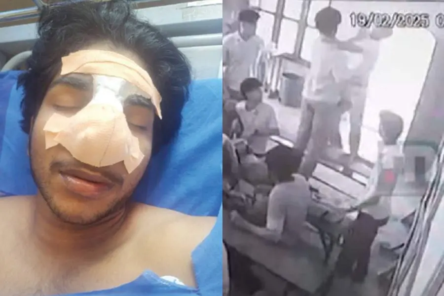 Kerala ITI student’s nose shattered in classroom fight, undergoes multiple reconstructive surgeries