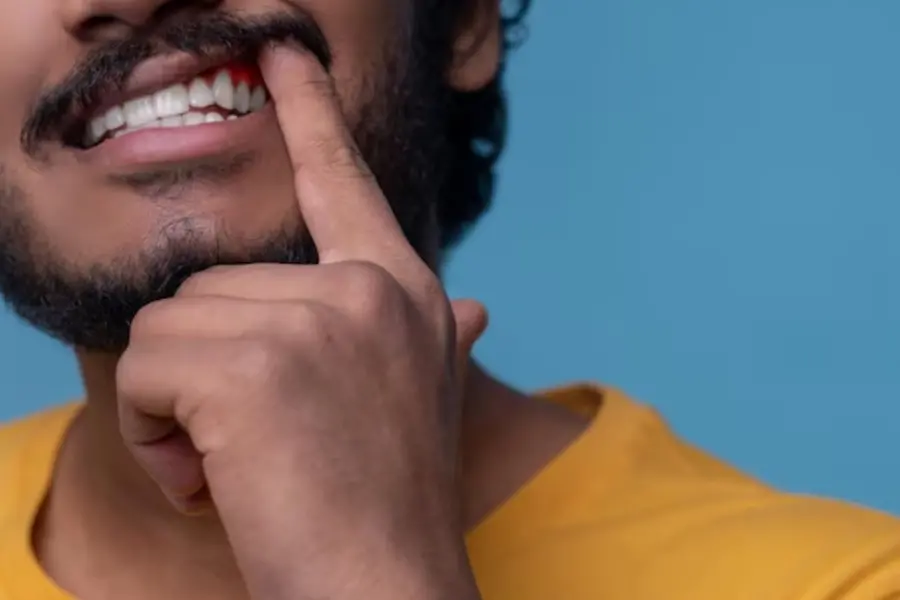 How to maintain dental health: Know why oral care matters