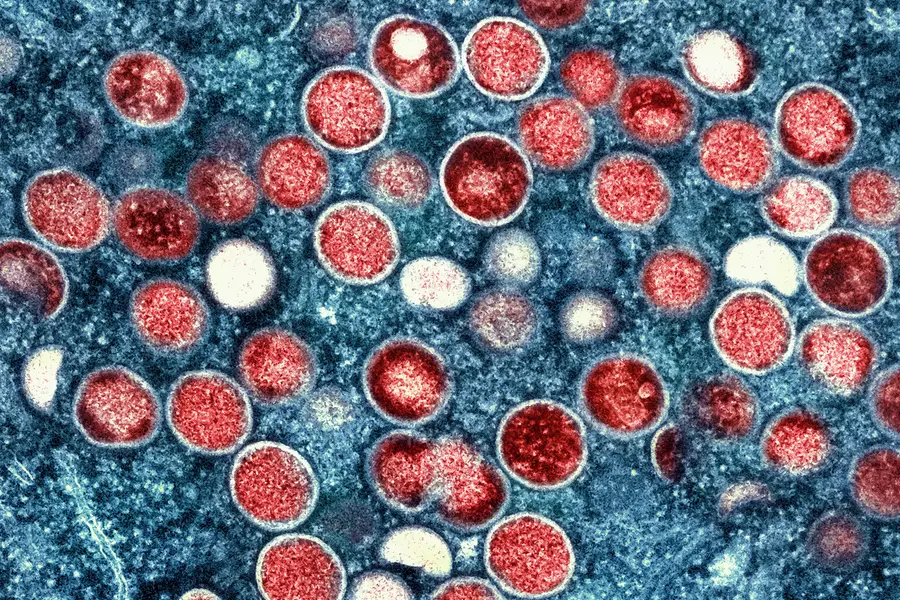 Karnataka govt announces free treatment for monkeypox patients