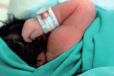 Baby born with deformities in Alappuzha faces health challenges; gender test confirms boy