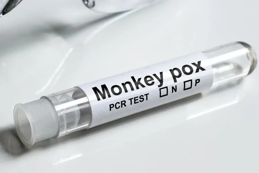 Mpox in Kerala: Know how it spreads and who is at risk