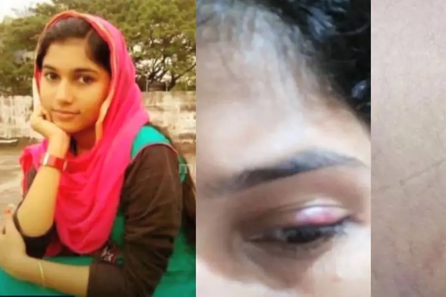 Malappuram woman dies in Abu Dhabi after sharing voice message in distress, pics of bruises
