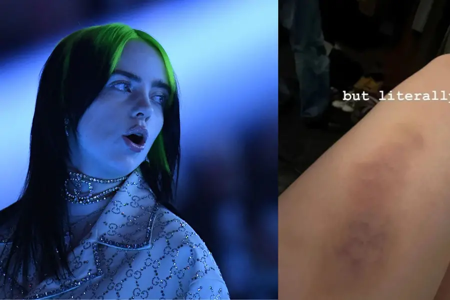 Billie Eilish suffers injury after dangerous fall on stage at New York concert | WATCH