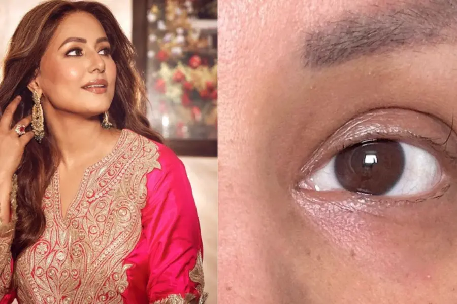 ‘My source of motivation’; Hina Khan shares picture of her last-standing eyelash