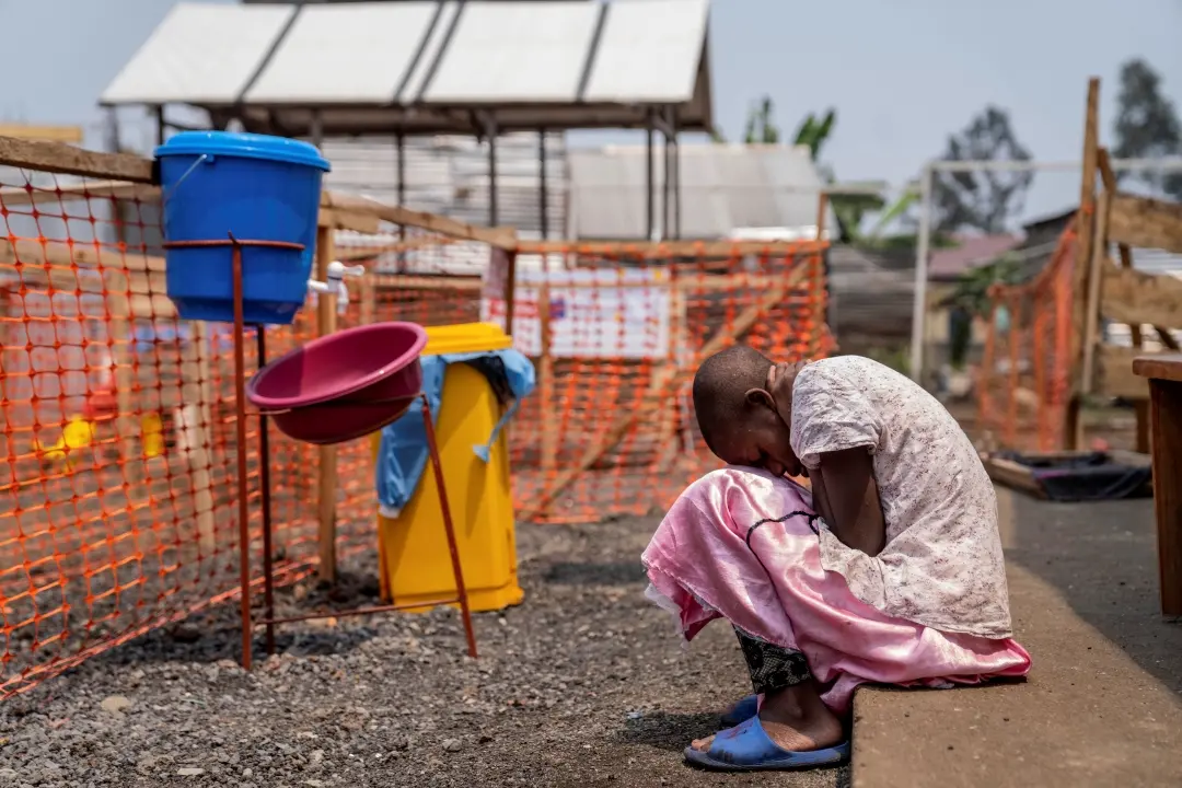 A young girl suffering from mpox wait for treatment at a clinic in Munigi, eastern Congo | Photo: AP