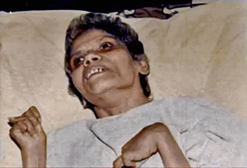 Aruna Shanbaug