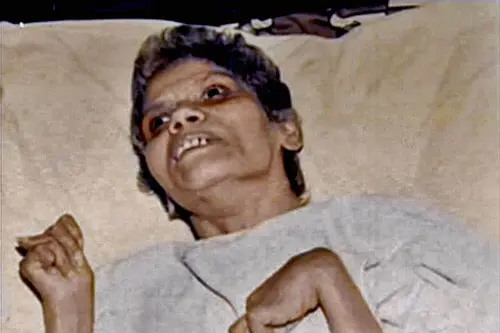 Remembering Aruna Shanbaug, nurse mentioned during suo motu hearing of Kolkata rape case