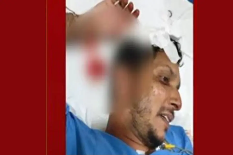 കണ്ണൂരില് ബിജെപി പ്രവര്ത്തകന് വെട്ടേറ്റു