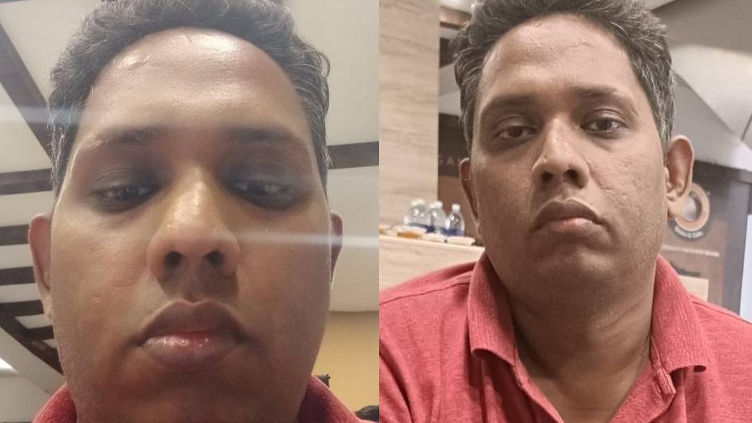 Obscene language: Police warns 'Arattanan' following actor Bala's complaint