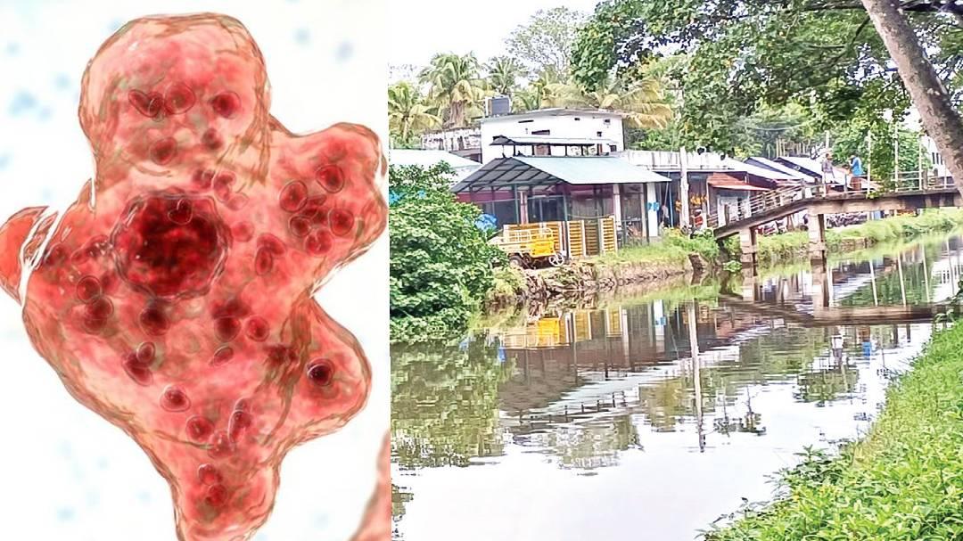 Death due to brain infection: three other minors under observation ...