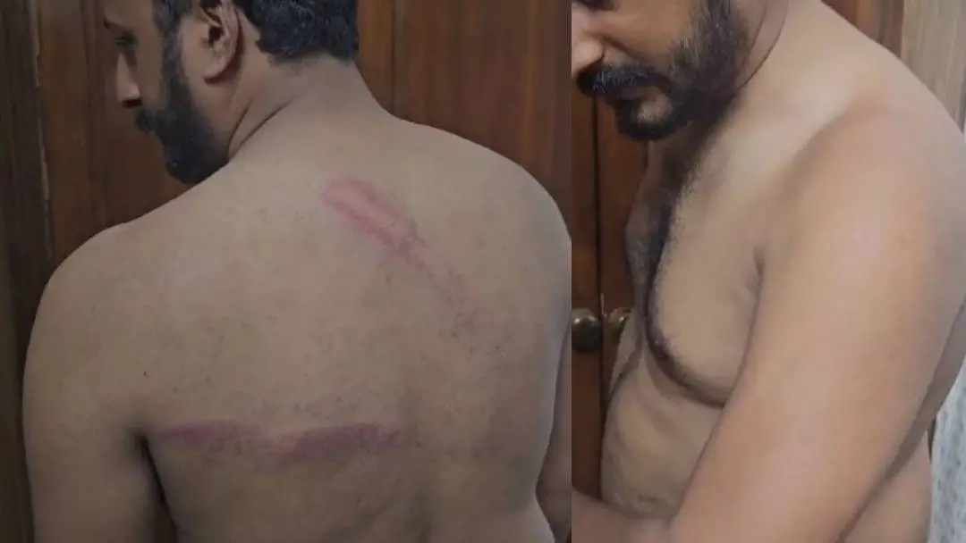 Rahul Mamkoottathil's injuries | Photo: Screengrab