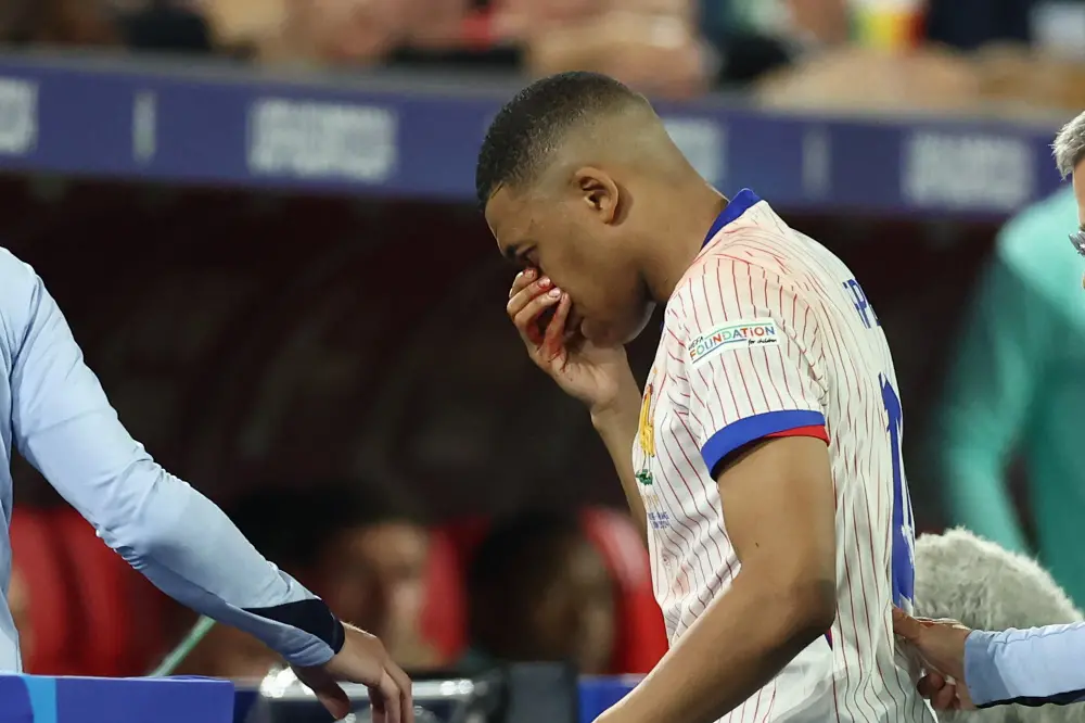 Kylian Mbappe leaves the pitch after being injured during the match | AFP