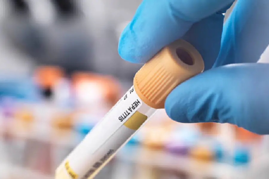 Matter of concern: Health department urges vigilance after viral hepatitis death in Malappuram