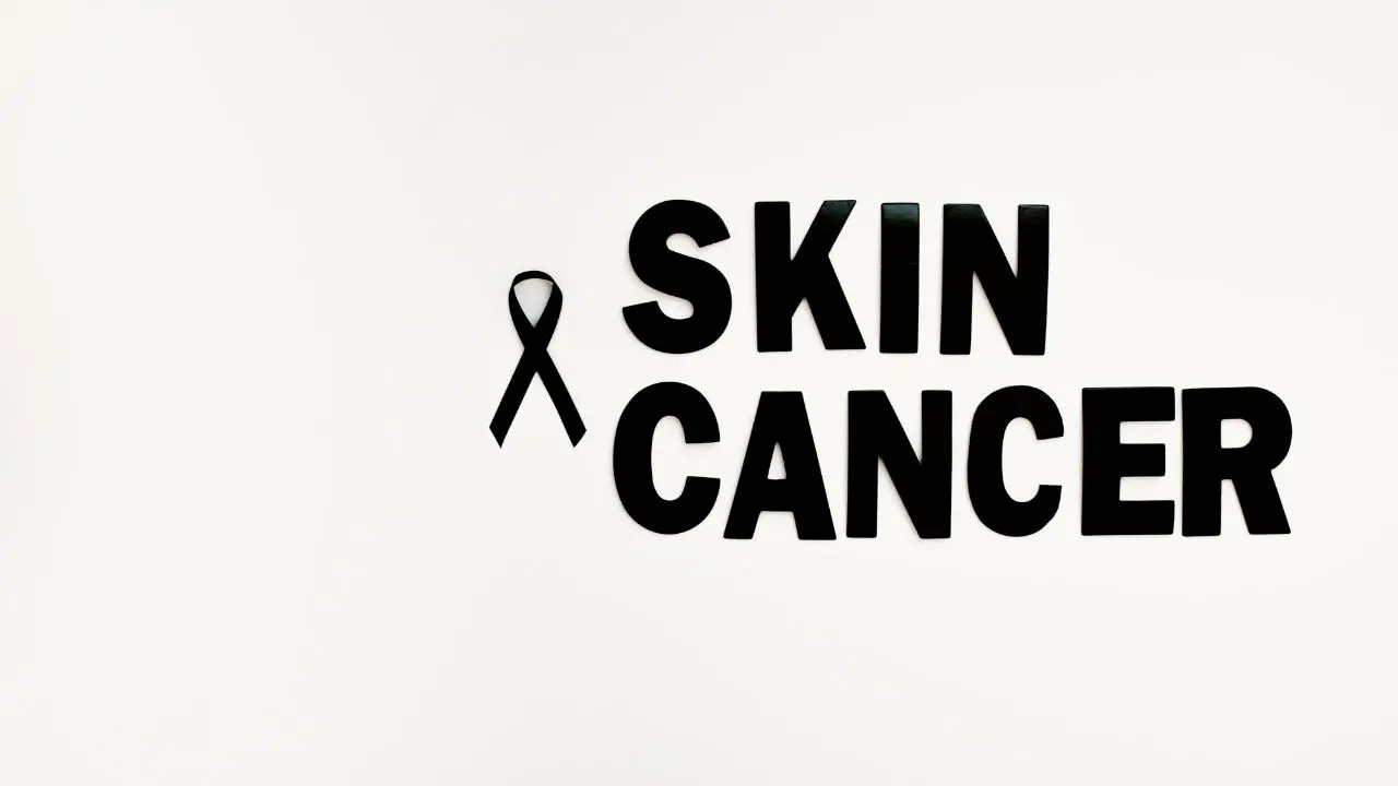 Skin cancer | photo: Mathrubhumi