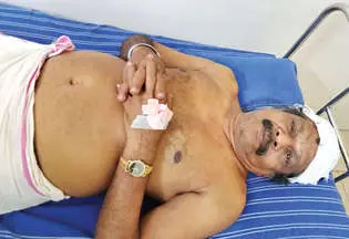Krishnadas at a private hospital in Thrissur