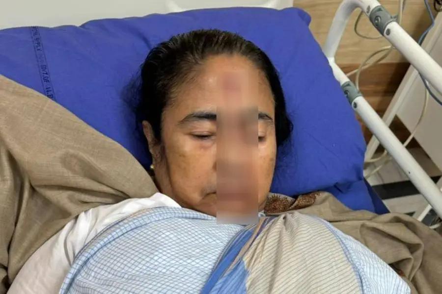 Mamata Banerjee suffers major injury on forehead; discharged after treatment at hospital