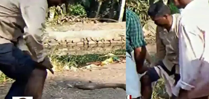Vava Suresh tending to the snake bite after being bitten by the cobra