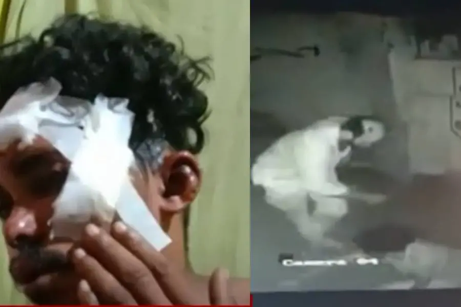 Assault on youth in TVM: Accused released on bail hours after arrest