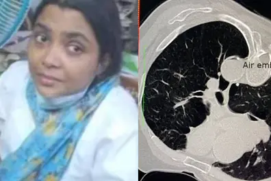 Alappuzha murder attempt: What is air embolism?