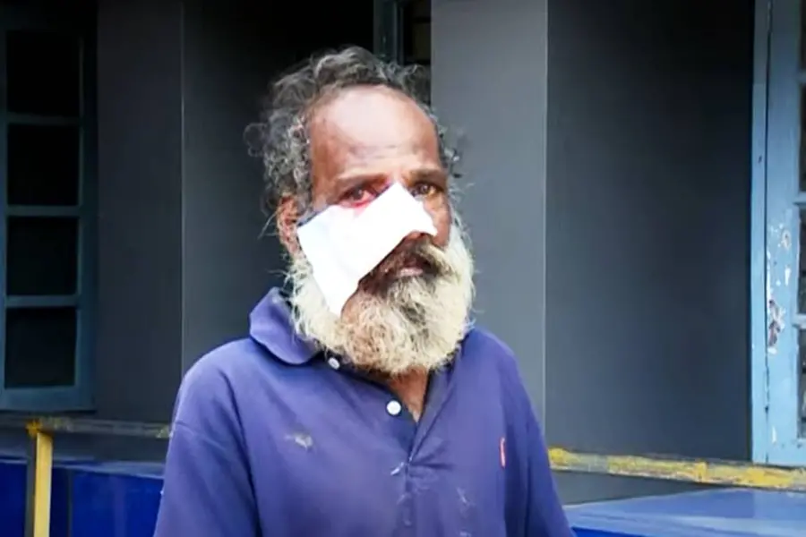 Palakkad man suffers severe dog bite on face