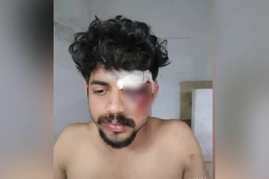Youth attacks doctor during treatment at Kalamassery MC, arrested