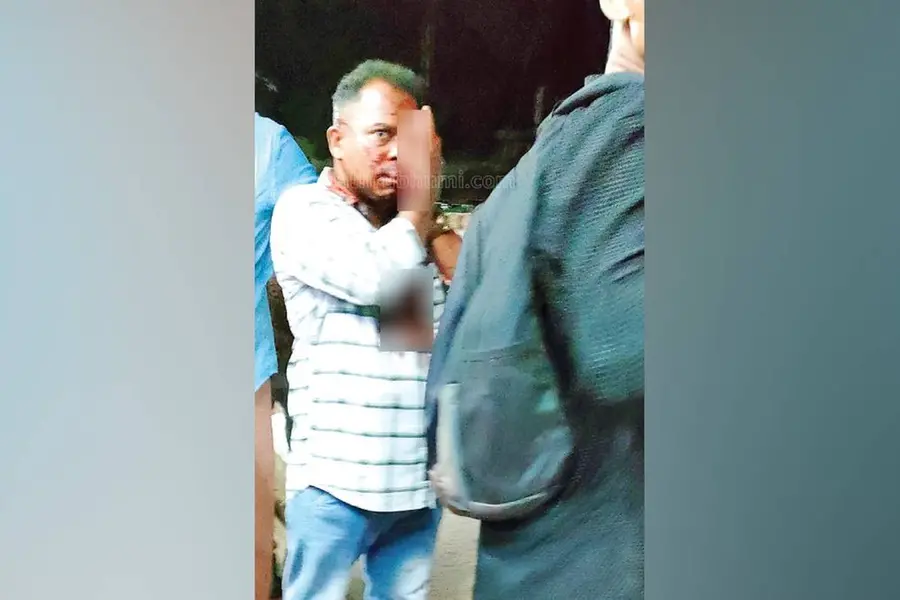 Kozhikode man suffers stab wound during train journey