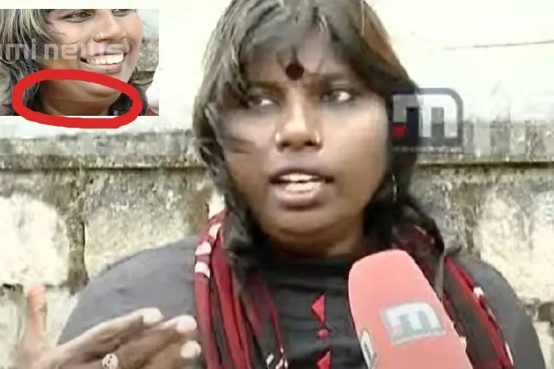 Female lawyer suffers neck injury as plastic string traps her on Thrissur road