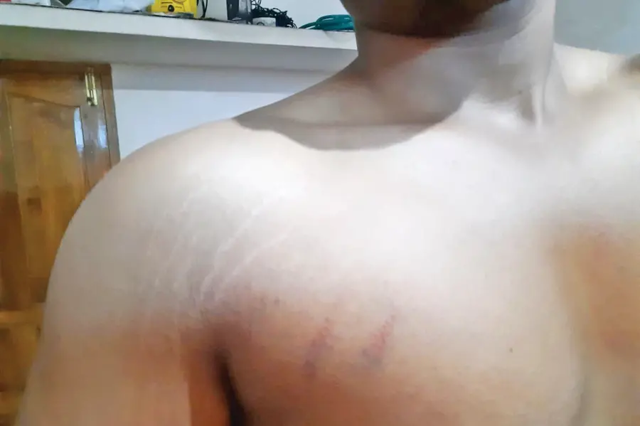 Cops beat up college student in custody