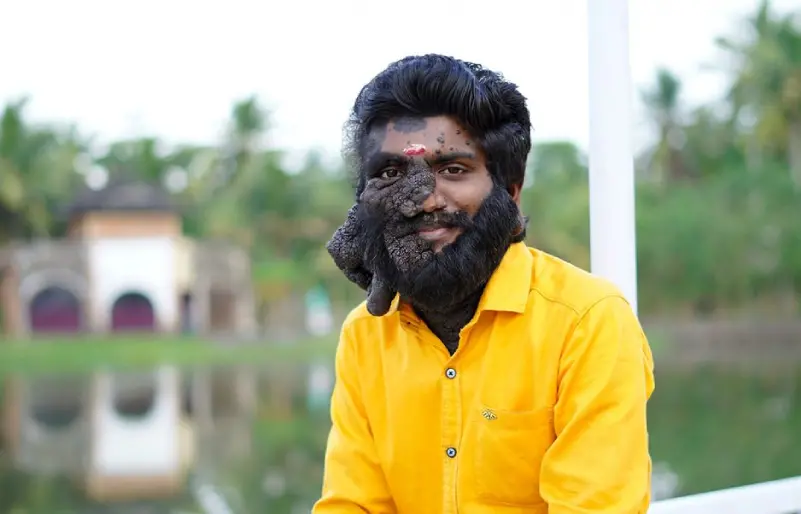 Photo: Facebook|prabhulal