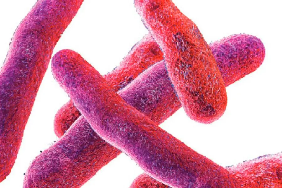 How did Shigella become deadly?