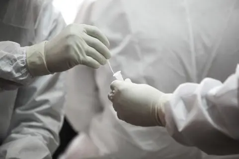 Private labs protest over slashing of RT-PCR test rates