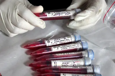 All who show Covid symptoms to be subjected to RT-PCR test