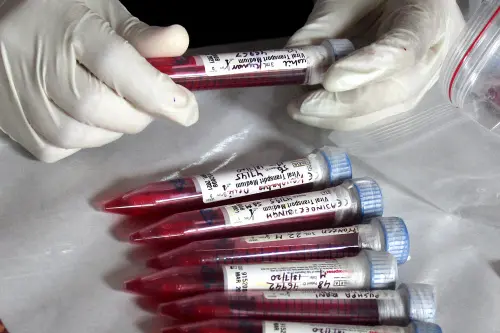 All who show Covid symptoms to be subjected to RT-PCR test
