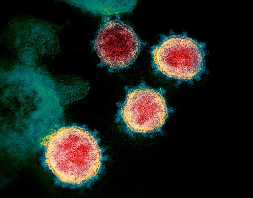 Undated electron microscope image of the virus that causes COVID-19. (AP photo)