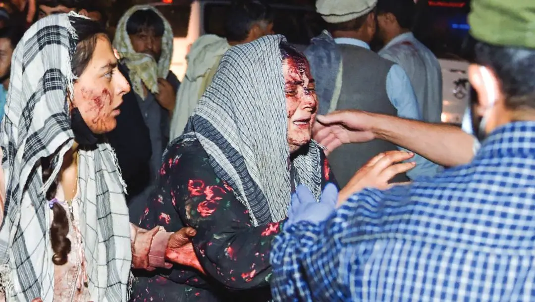 Woman injured in Kabul blast being taken to hospital | Photo: AFP