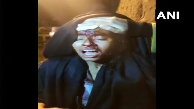 JNUSU President Aishe Ghosh injured in the attack (ANI photo)