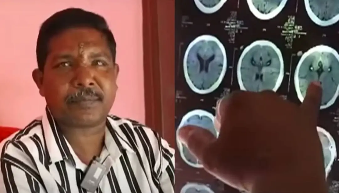 Sunil Abraham; CT Scan