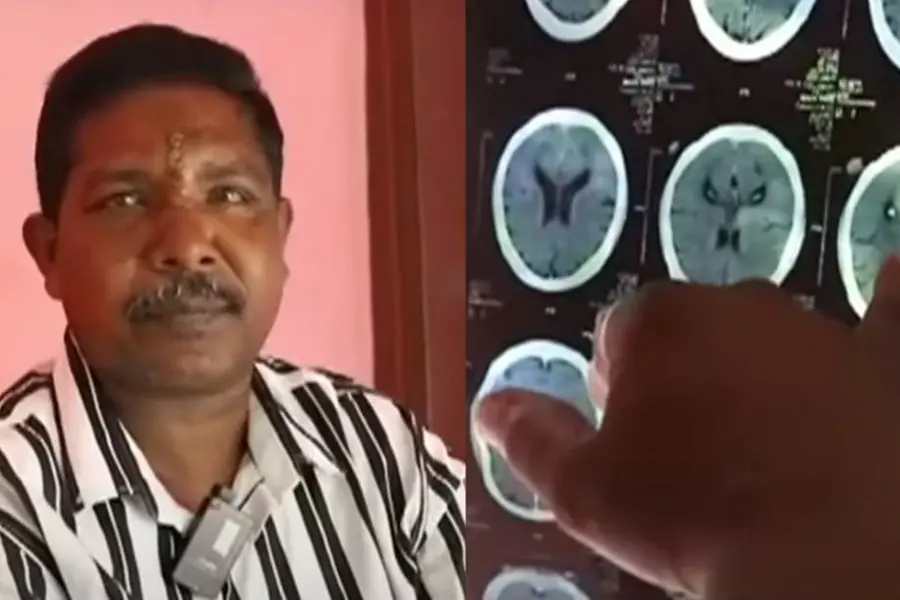Ants sewn into forehead wound; Complaint filed against Ranni Taluk Hospital