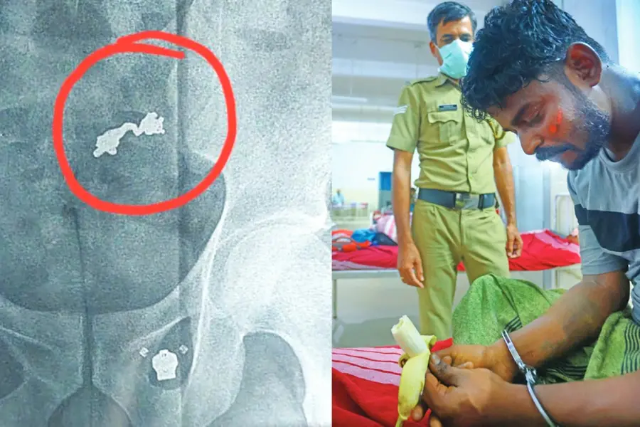 Cops feed thief with good food, bananas and monitor toilet to recover evidence in bizarre theft case
