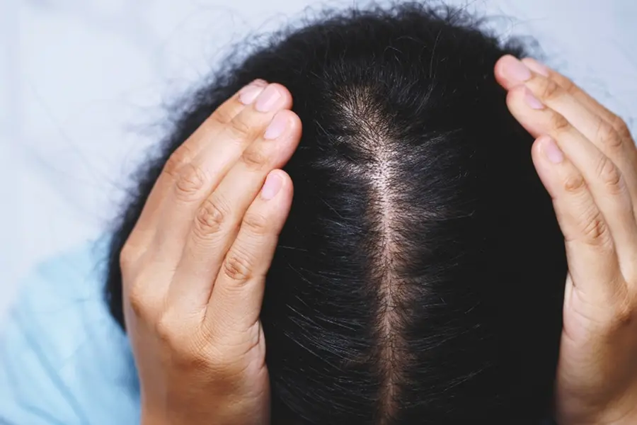 Is your scalp burning in the sun? Why it happens and how to stop it
