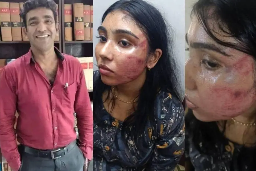 assault case