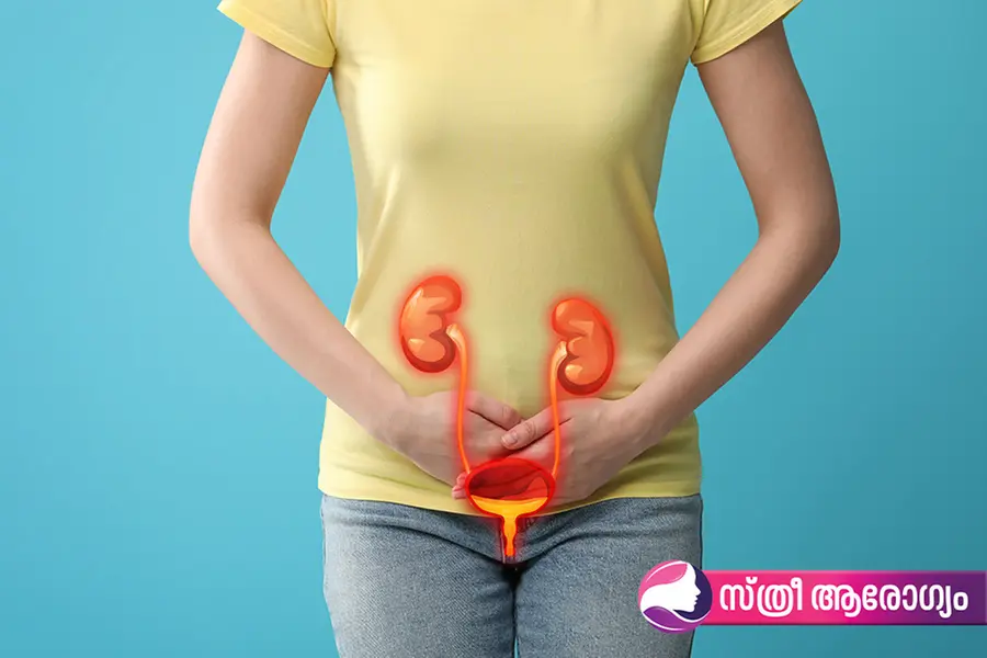 സ്ത്രീകളിൽ മൂത്രനാളിയിലെ അണുബാധ; ചികിത്സ വൈകിപ്പിക്കരുത്