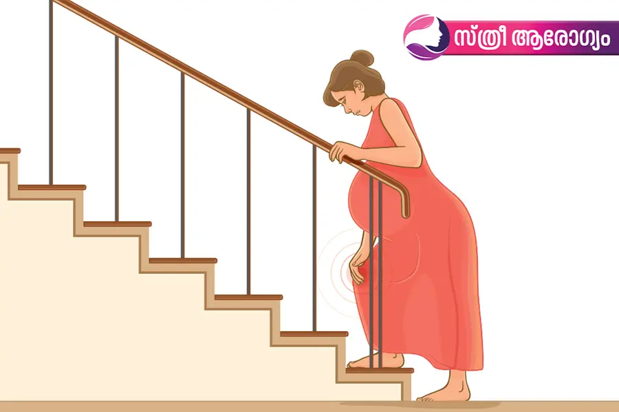 സന്ധിവാതരോഗമുള്ളവര്‍ ഗര്‍ഭകാലത്തെടുക്കേണ്ട മുന്‍കരുതലുകള്‍
