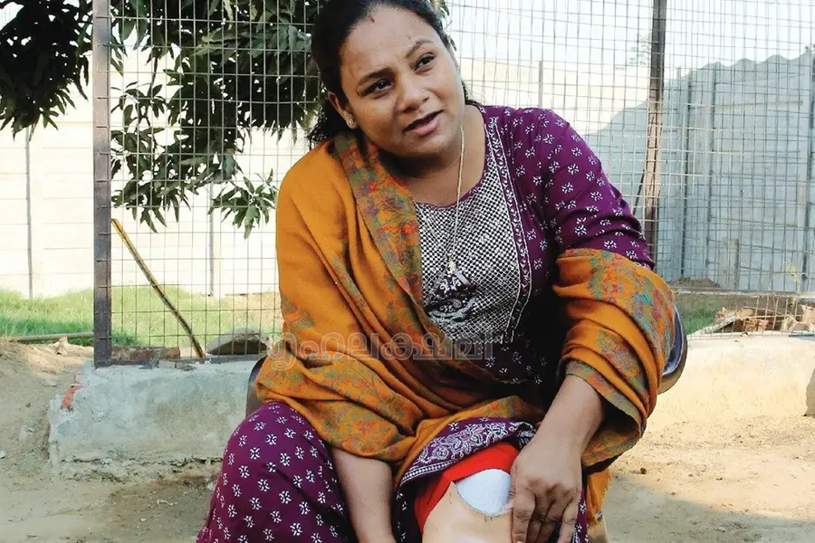 ഒറ്റക്കാലില് എവറസ്റ്റ് കീഴടക്കി; തീവണ്ടി കയറി അറ്റുപോയ കാല് എലികള് കരണ്ടു