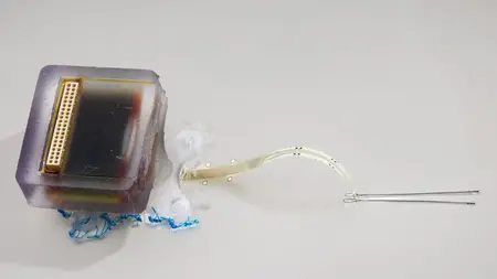 Implantable electronic device