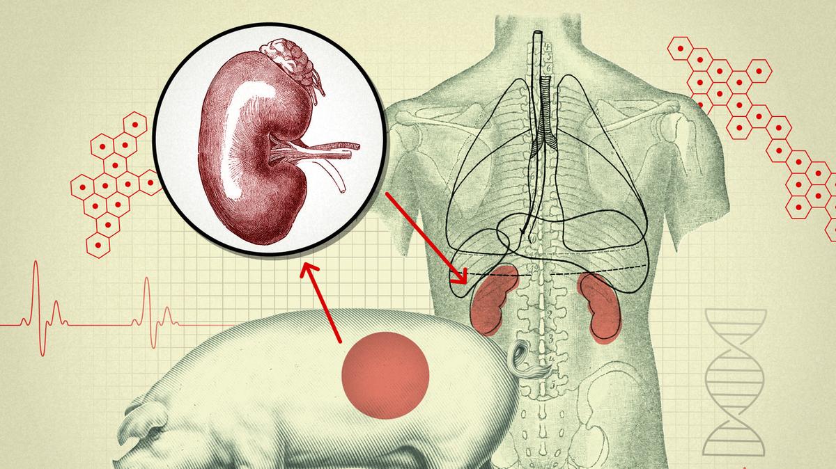 Can a pig kidney work in humans? Scientists get closer to making animal ...