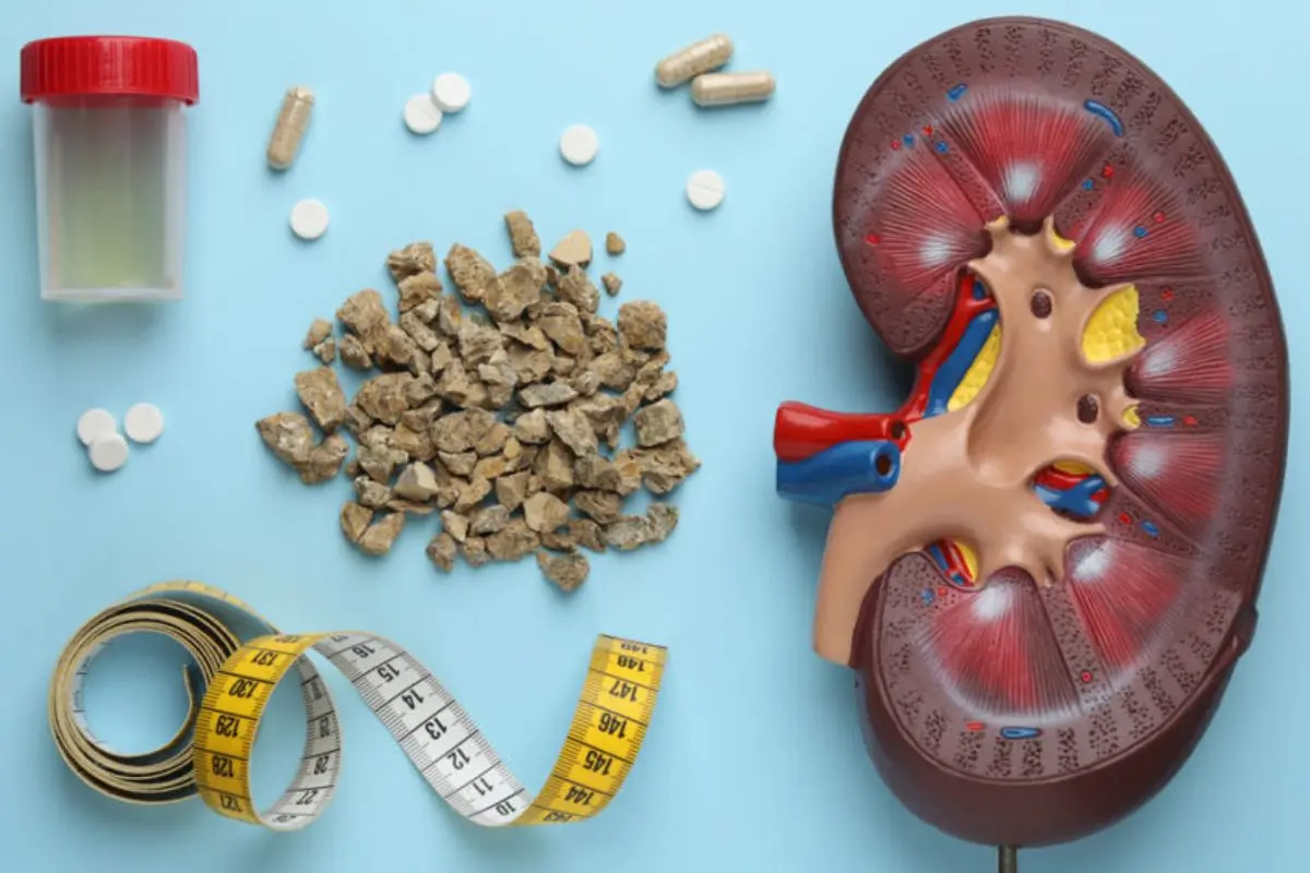Doctors urge youngsters and women experiencing urinary symptoms to seek timely management. Photo: X
